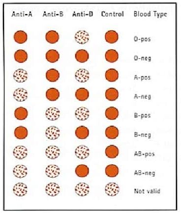 Load image into Gallery viewer, Blood Typing Kit, 1 Test, Know Your Blood Type, Instant Home Testing Kit
